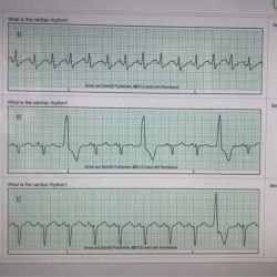 Relias medical surgical telemetry b