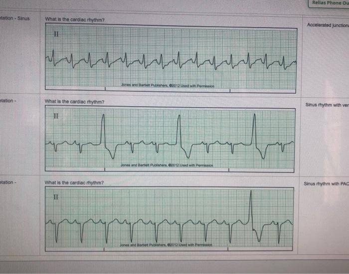 Relias medical surgical telemetry b