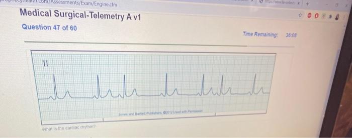 Relias medical surgical telemetry b