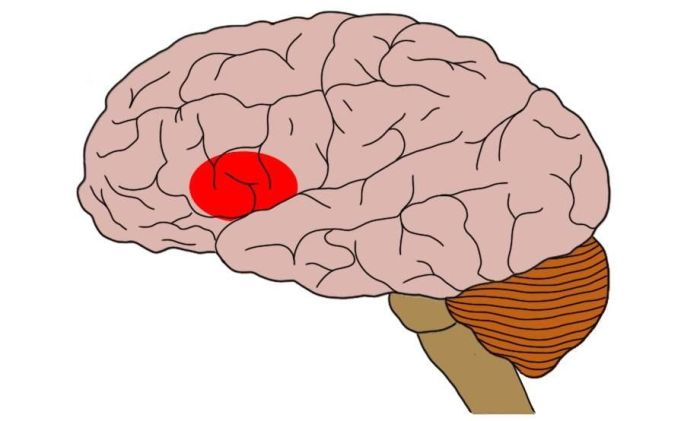 Brain region linked to speech crossword