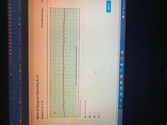 Relias medical surgical telemetry b